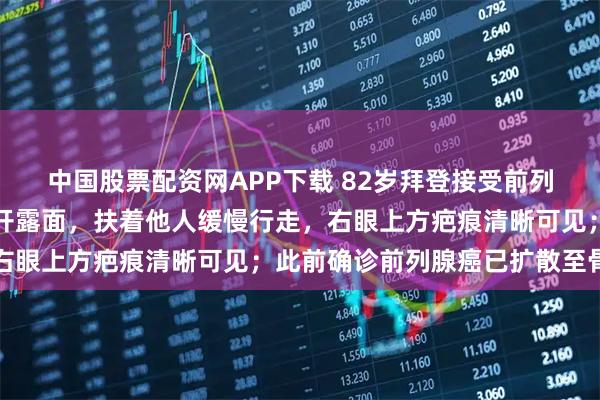 中国股票配资网APP下载 82岁拜登接受前列腺癌放射治疗后首次公开露面，扶着他人缓慢行走，右眼上方疤痕清晰可见；此前确诊前列腺癌已扩散至骨头